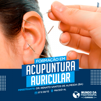 Acupuntura Auricular